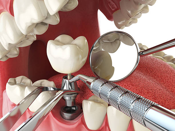 Best Emergency Dental Extractions in Tiltonsville, OH
